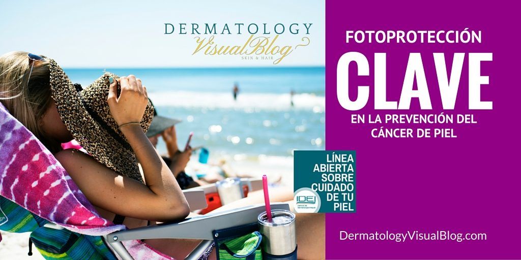 CONSEJOS PARA LA PREVENCIÓN DEL CÁNCER DE PIEL