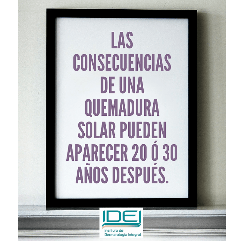 Consecuencias de una quemadura solar y cómo tratarla Consecuencias de una quemadura solar y cómo tratarla