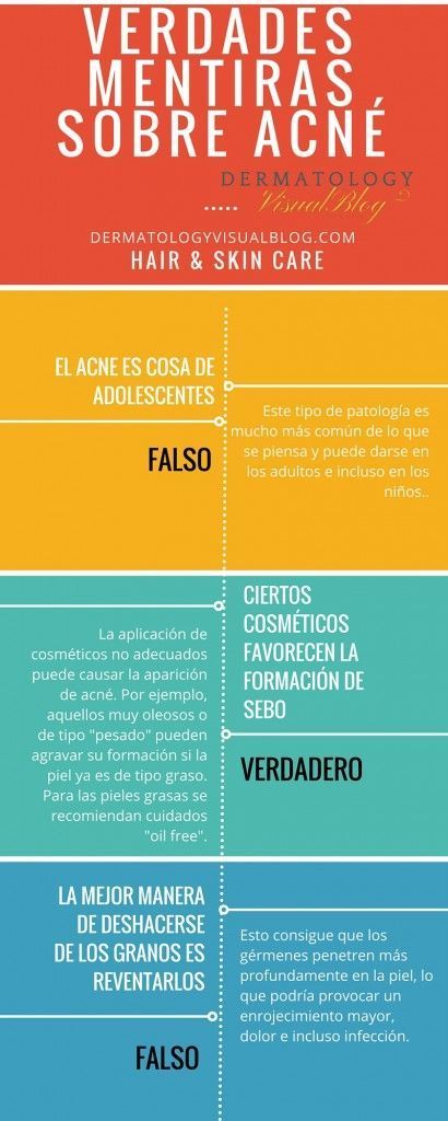 Verdades y mentiras sobre el acne