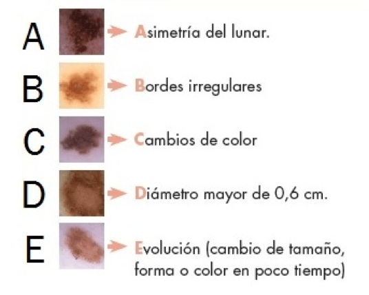 Regla ABCDE