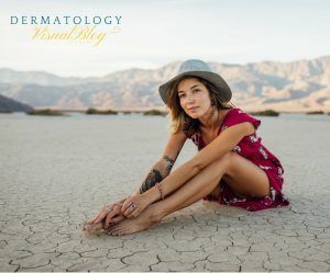 ¿Son peligrosos los tatuajes? ¿Cómo eliminarlos?