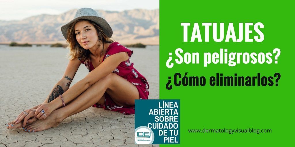 Son peligrosos los tatuajes y como puedo eliminarlos