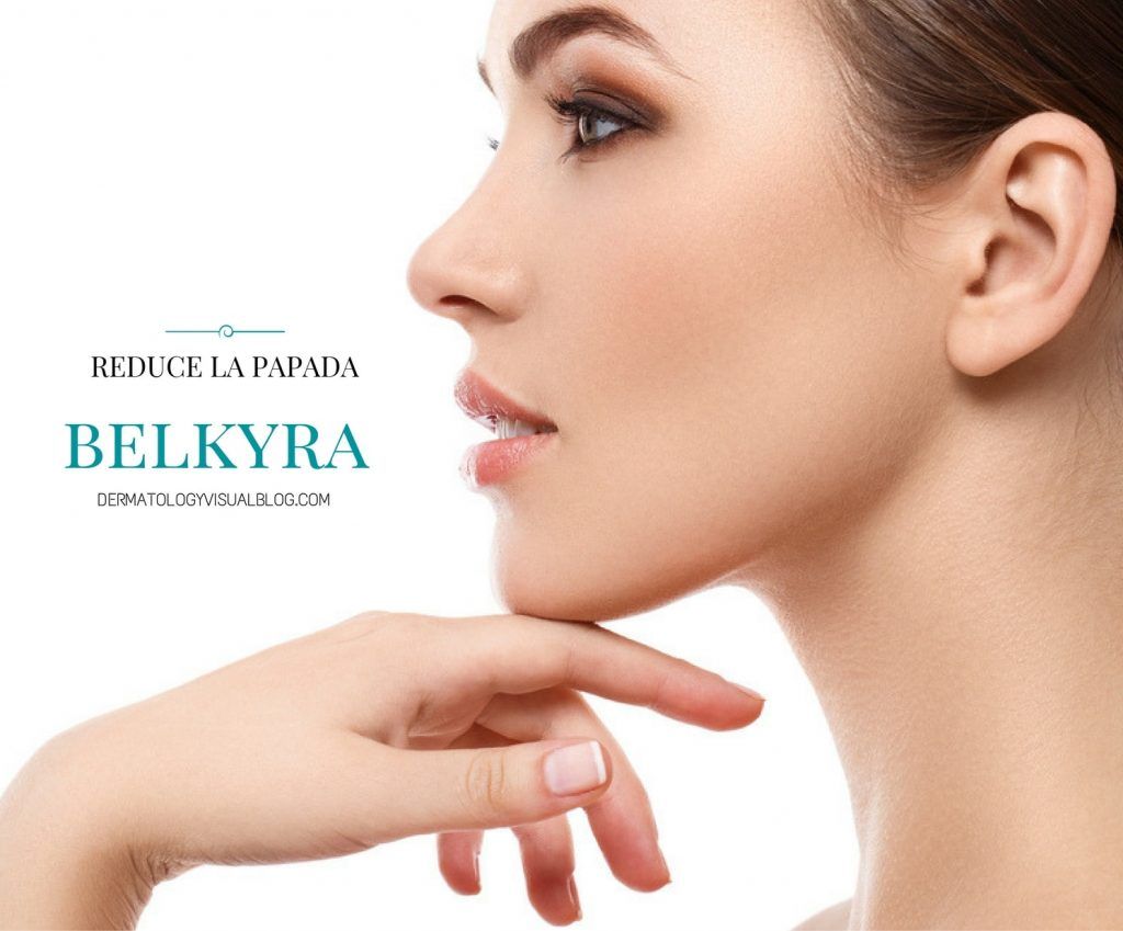 Belkyra, la solución más avanzada para la reducción de la papada