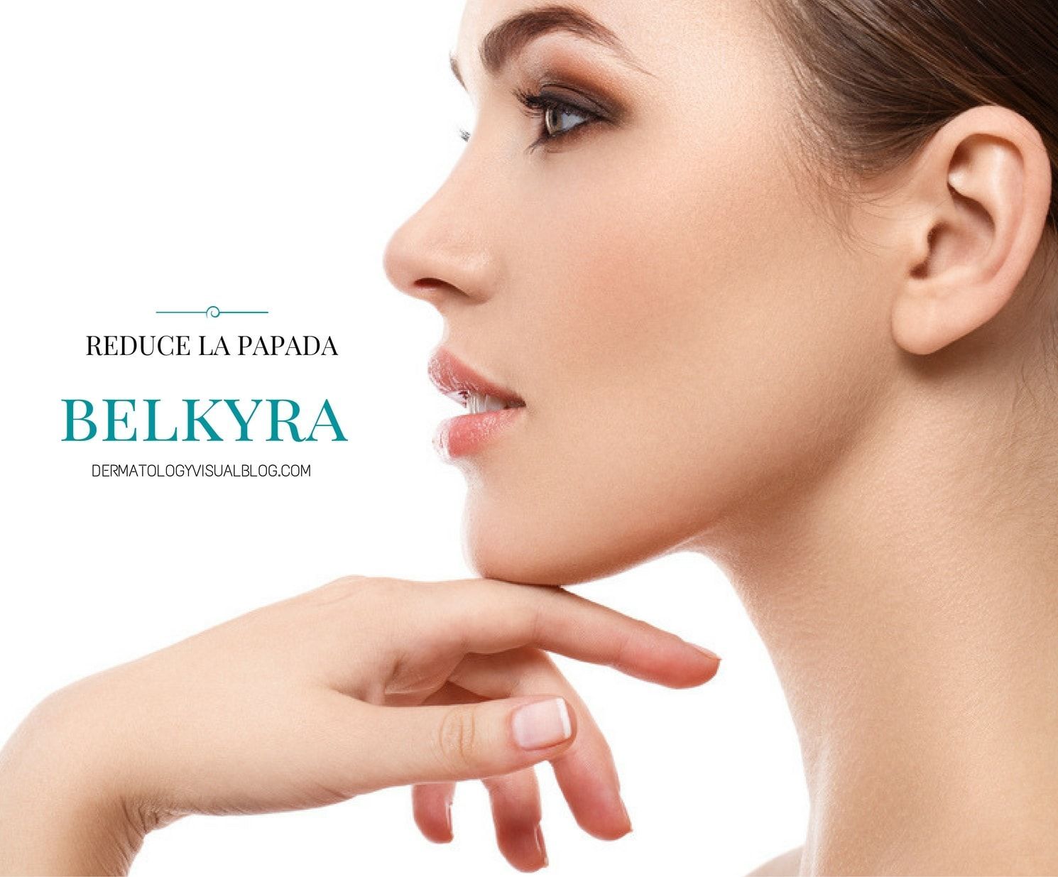 Belkyra, la solución más avanzada para la reducción de la papada