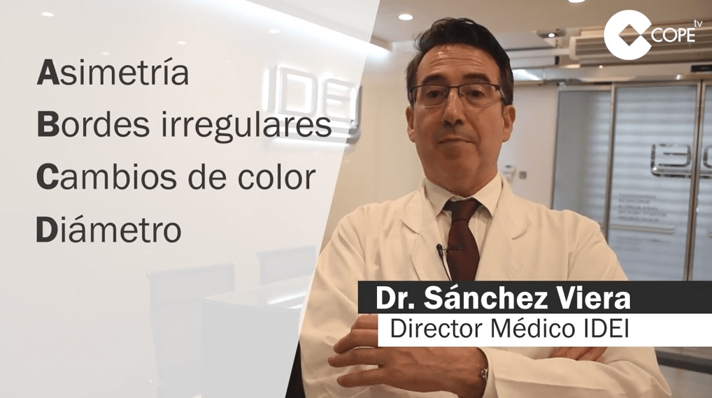 ¿Qué características tiene un lunar maligno?