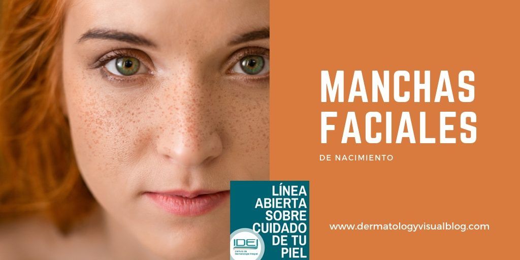 Manchas faciales