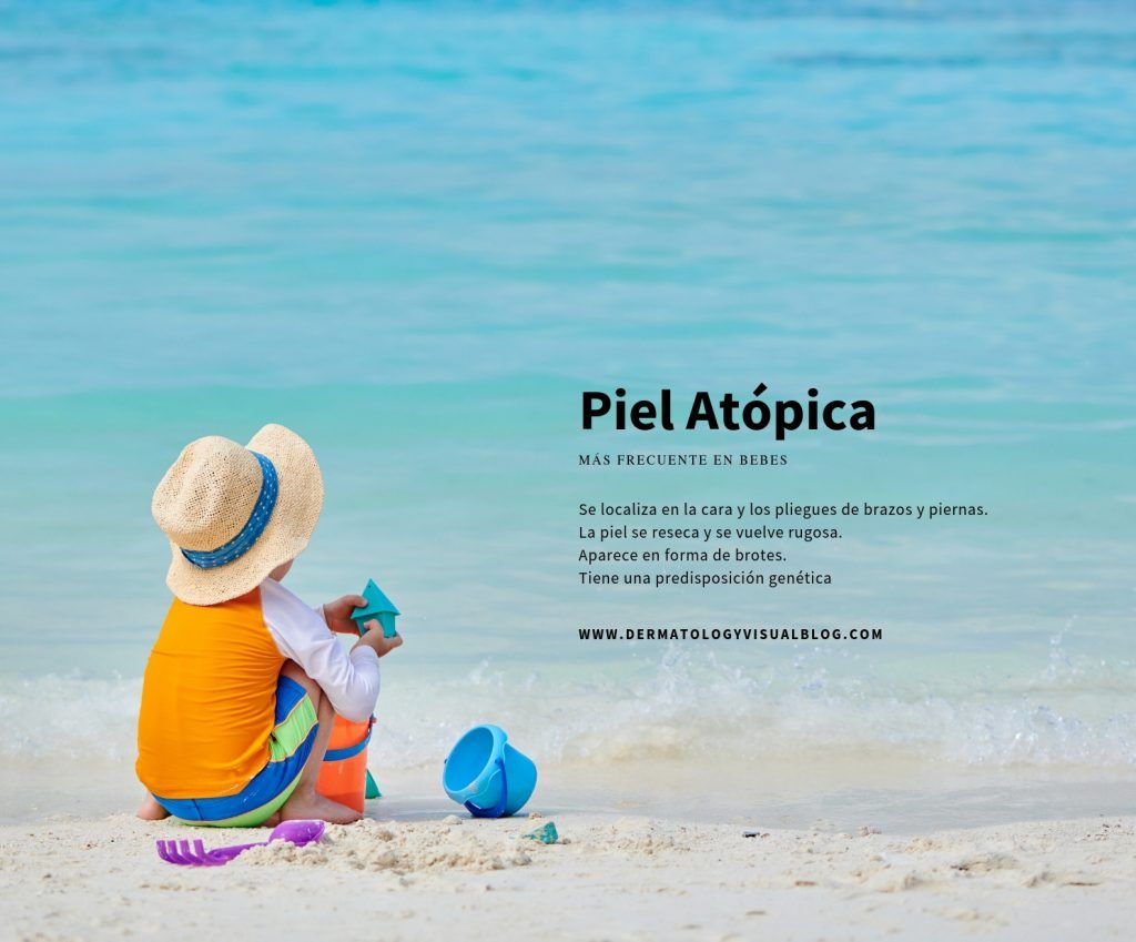 Piel atópica, que es y cómo cuidarla