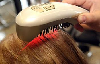 como_tratar_alopecia_con_laser