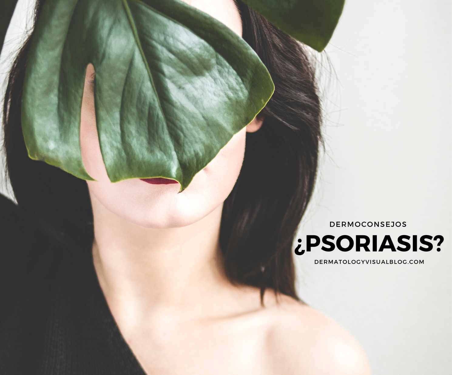 Psoriasis; qué es y cómo debes cuidar tu piel