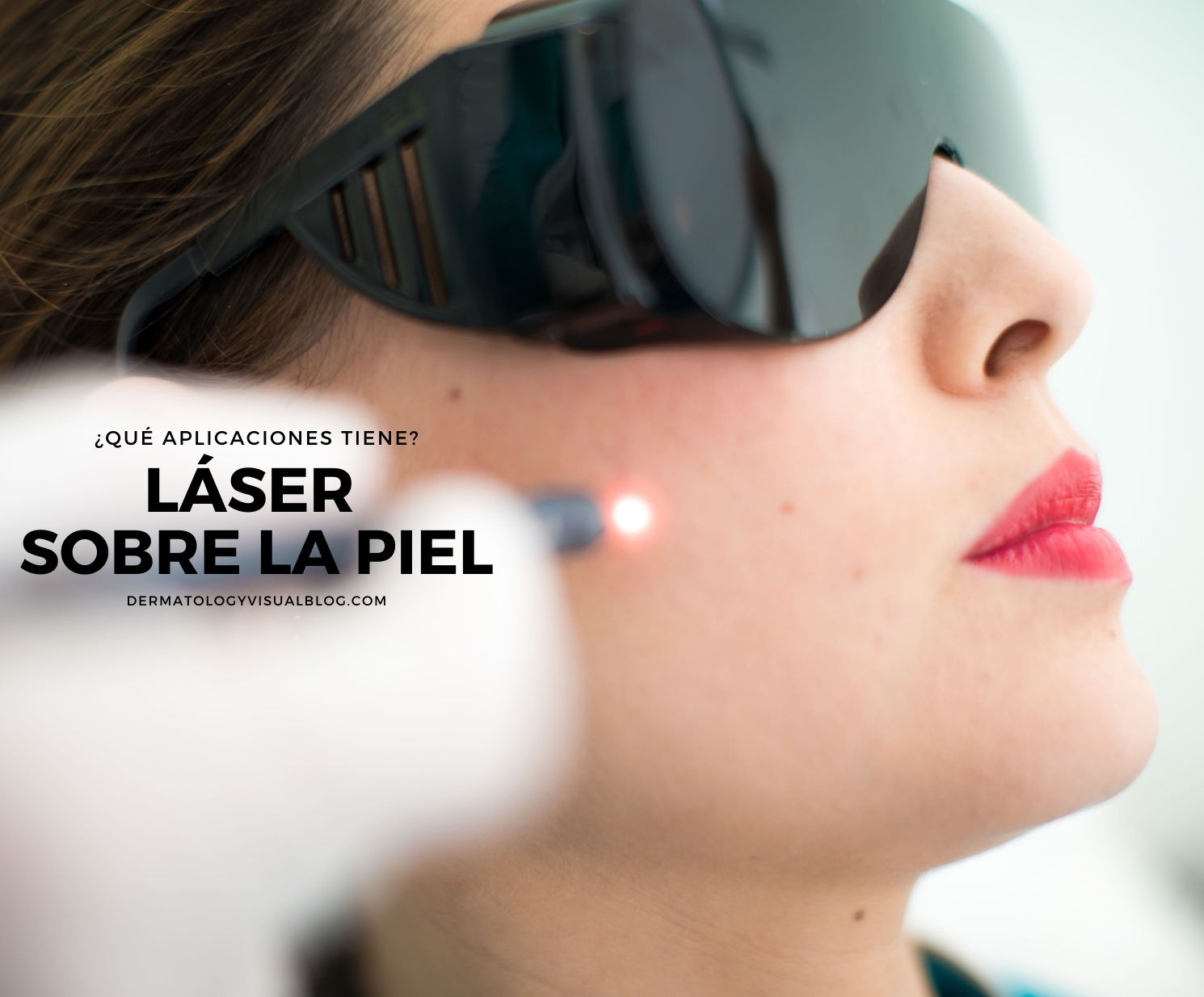 Aplicaciones del laser sobre la piel. Respuestas de los especialistas