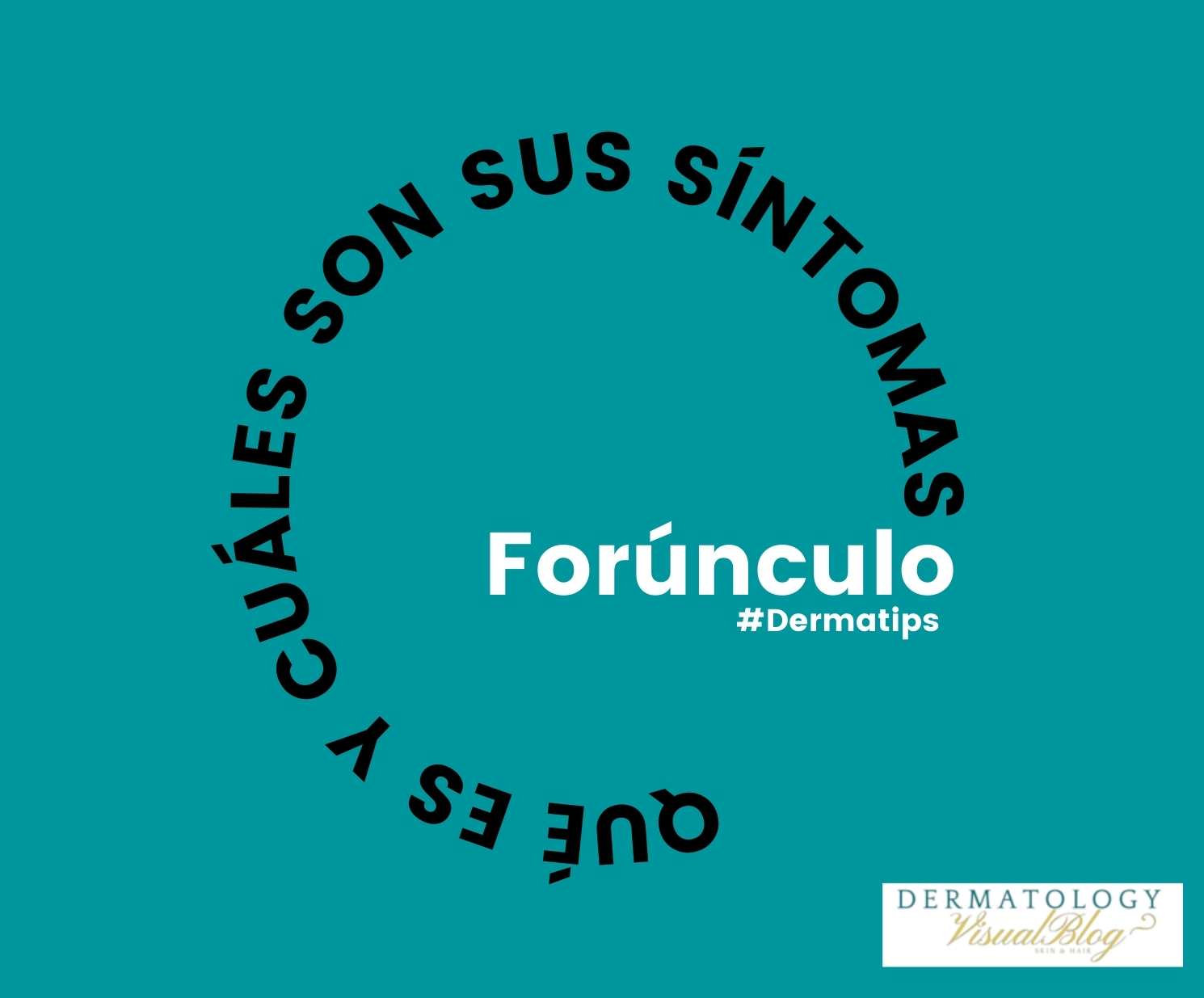 Forúnculo que es y cuales son sus síntomas